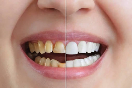 Patient discussing cosmetic and aesthetic dental treatment options at Gold's Dental Clinic